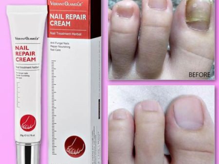 Vibrant Glamour Nail Repair Cream Anti Fungal Nails Repair Nourishing- 20g Online Hot Sale