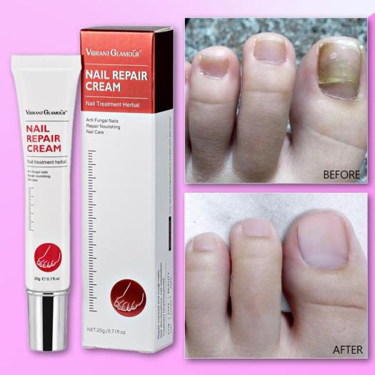 Vibrant Glamour Nail Repair Cream Anti Fungal Nails Repair Nourishing- 20g Online Hot Sale